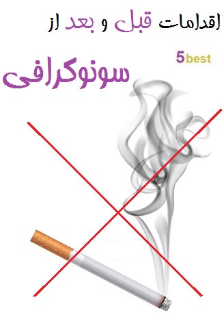 اقدامات قبل و بعد از سونوگرافی کدامند؟