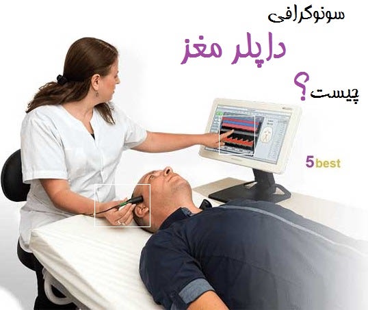 سونوگرافی داپلر مغز چیست؟