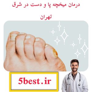 درمان میخچه پا و دست در شرق تهران
