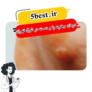 درمان میخچه پا و دست در شرق تهران