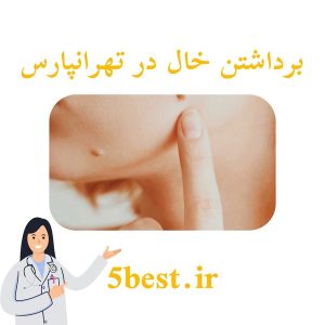برداشتن خال در تهرانپارس