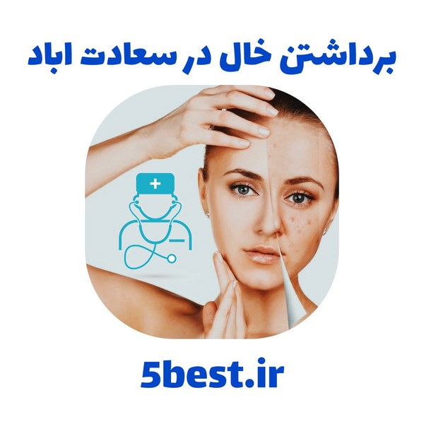 برداشتن خال در سعادت اباد