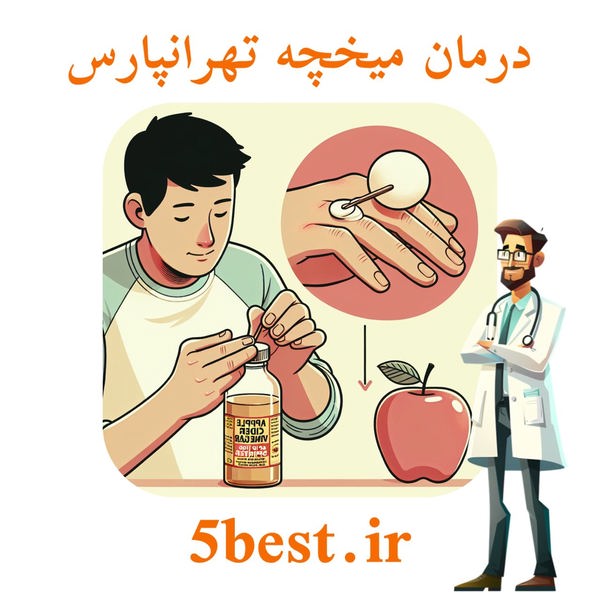 درمان میخچه تهرانپارس