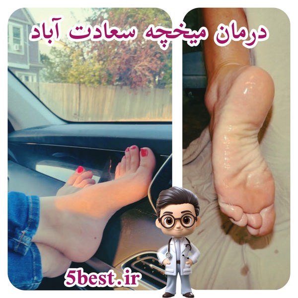 درمان میخچه سعادت اباد