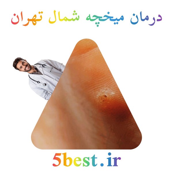 درمان میخچه شمال تهران
