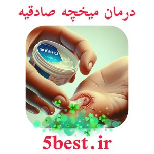 درمان میخچه صادقیه