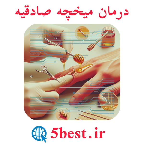 درمان میخچه صادقیه