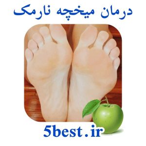 درمان میخچه نارمک