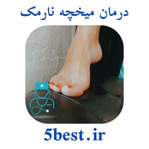 درمان میخچه نارمک