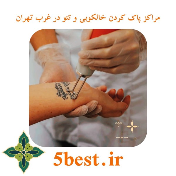 مراکز پاک کردن خالکوبی و تتو در غرب تهران