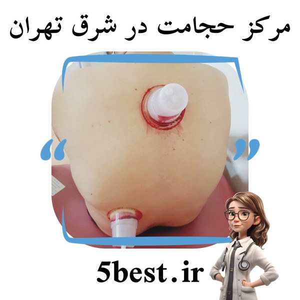 مرکز حجامت در شرق تهران