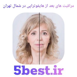 مراقبت های بعد از درمان هایفوتراپی در شمال تهران