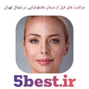 مراقبت های قبل از درمان هایفوتراپی در شمال تهران