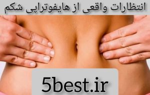 انتظارات واقعی از هایفوتراپی شکم