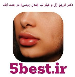 دکتر تزریق ژل و فیلر لب ( مدل روسی ) در جنت اباد