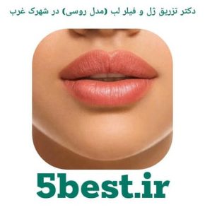 دکتر تزریق ژل و فیلر لب ( مدل روسی ) در شهرک غرب
