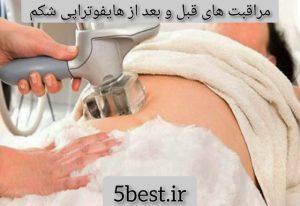 مراقبت های قبل و بعد از هایفوتراپی شکم