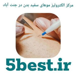 مراکز الکترولیز موهای سفید بدن در جنت اباد