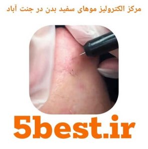 مراکز الکترولیز موهای سفید بدن در جنت اباد