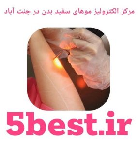 مراکز الکترولیز موهای سفید بدن در جنت اباد
