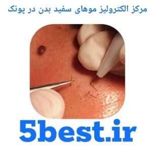 مراکز الکترولیز موهای سفید بدن در پونک