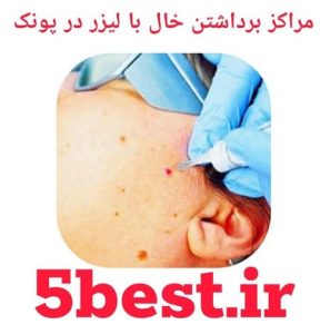مراکز برداشتن خال با لیزر در پونک