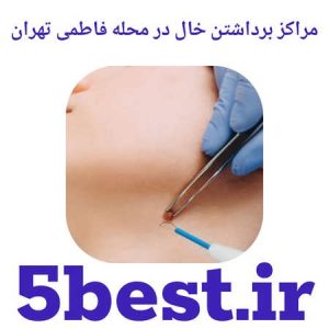 مراکز برداشتن خال در محله فاطمی تهران