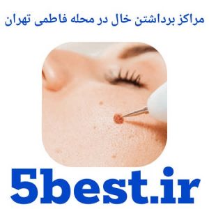 مراکز برداشتن خال در محله فاطمی تهران