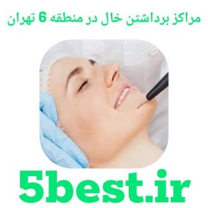 مراکز برداشتن خال در منطقه 6 تهران
