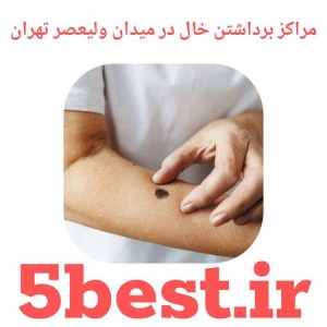 مراکز برداشتن خال در میدان ولیعصر تهران