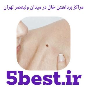 مراکز برداشتن خال در میدان ولیعصر تهران