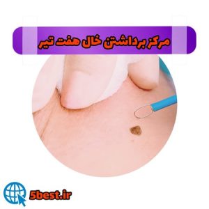 مراکز برداشتن خال هفت تیر تهران