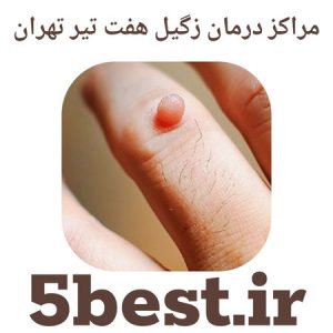 مراکز درمان زگیل هفت تیر تهران
