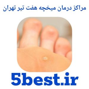 مراکز درمان میخچه هفت تیر تهران