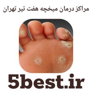 مراکز درمان میخچه هفت تیر تهران