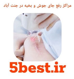 مراکز رفع جای جوش و بخیه در جنت اباد