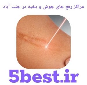 مراکز رفع جای جوش و بخیه در جنت اباد