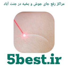 مراکز رفع جای جوش و بخیه در جنت اباد
