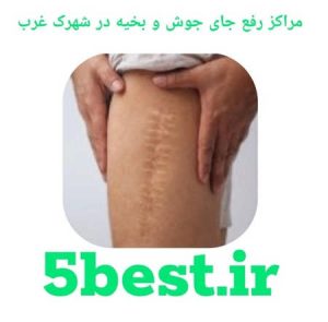مراکز رفع جای جوش و بخیه در شهرک غرب