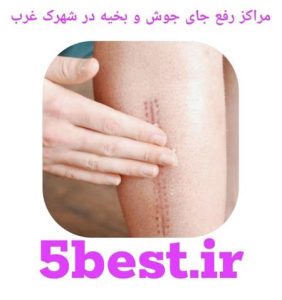 مراکز رفع جای جوش و بخیه در شهرک غرب