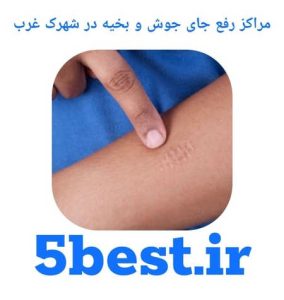 مراکز رفع جای جوش و بخیه در شهرک غرب