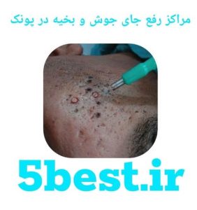 مراکز رفع جای جوش و بخیه در پونک