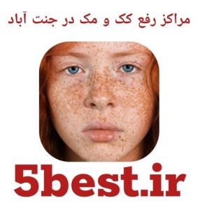 مراکز رفع کک و مک در جنت اباد