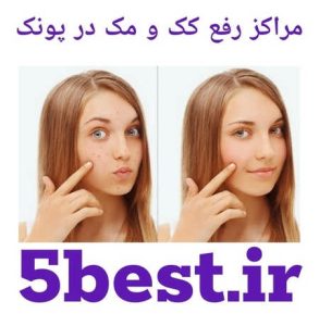 مراکز رفع کک و مک پونک 