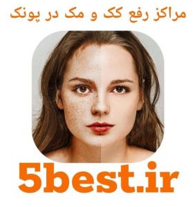 مراکز رفع کک و مک پونک 