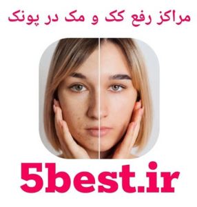 مراکز رفع کک و مک پونک 
