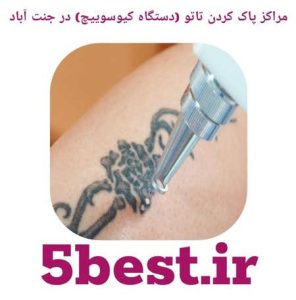 مراکز پاک کردن تاتو ( دستگاه کیوسوییچ ) در جنت اباد