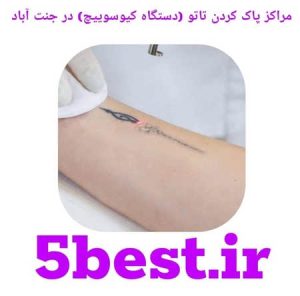 مراکز پاک کردن تاتو ( دستگاه کیوسوییچ ) در جنت اباد