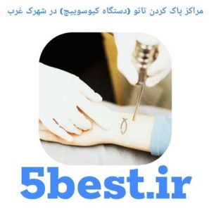مراکز پاک کردن تاتو ( دستگاه کیوسوییچ ) در شهرک غرب