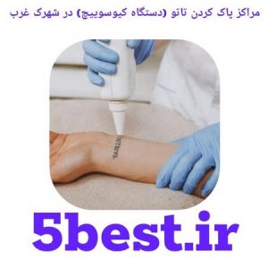 مراکز پاک کردن تاتو ( دستگاه کیوسوییچ ) در شهرک غرب